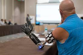 Top Resources in Prosthetics Engineering
